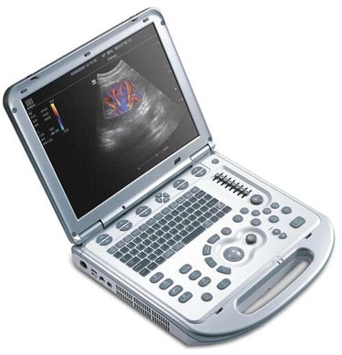 Chiropractic Bowie MD Muscuoloskeletal Ultrasound Monitor